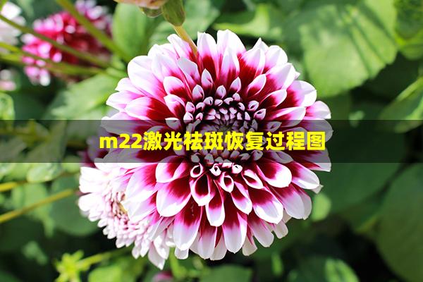 m22激光祛斑恢复过程图