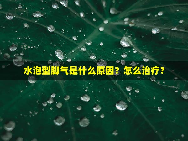 水泡型脚气是什么原因？怎么治疗？