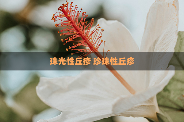 珠光性丘疹 珍珠性丘疹