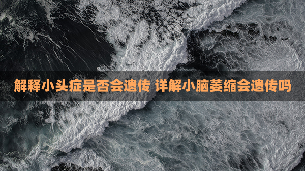 解释小头症是否会遗传 详解小脑萎缩会遗传吗