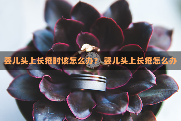 婴儿头上长疮时该怎么办？ 婴儿头上长疮怎么办